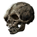 Malformed Skull
